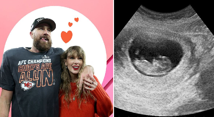 “Breaking news: Travis Kelce ecstatically confirms he and girlfriend Taylor Swift are expecting their first child. “I am overjoyed to share that I will soon be a dad,” Kelce announced.”