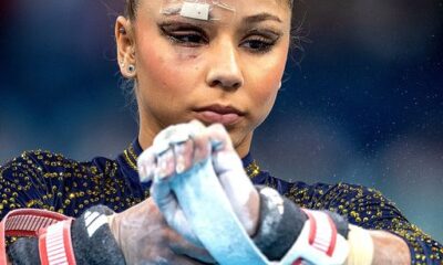 Olympic gymnast Flavia Saraiva shocked viewers after competing with a bandaged face.