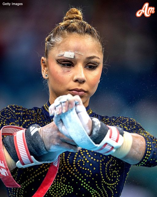 Olympic gymnast Flavia Saraiva shocked viewers after competing with a bandaged face.